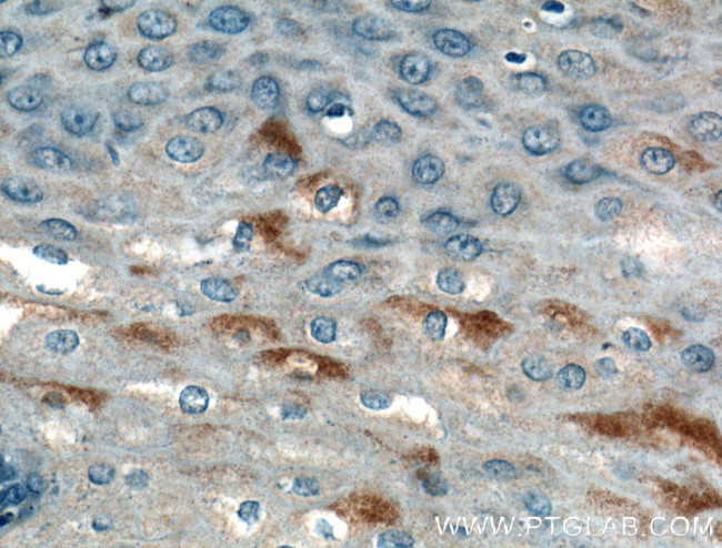 AGRP Antibody in Immunohistochemistry (Paraffin) (IHC (P))