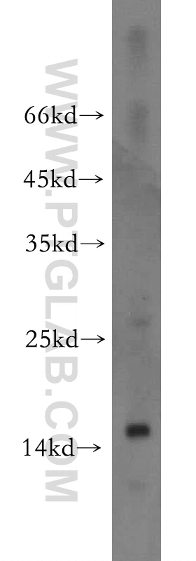 FABP2 Antibody in Western Blot (WB)