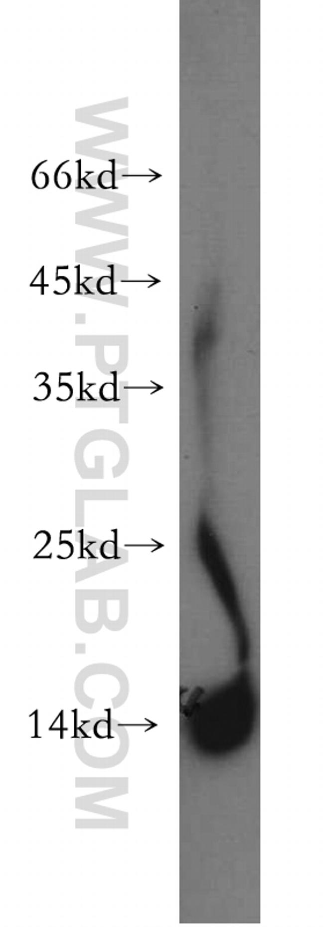 FABP2 Antibody in Western Blot (WB)