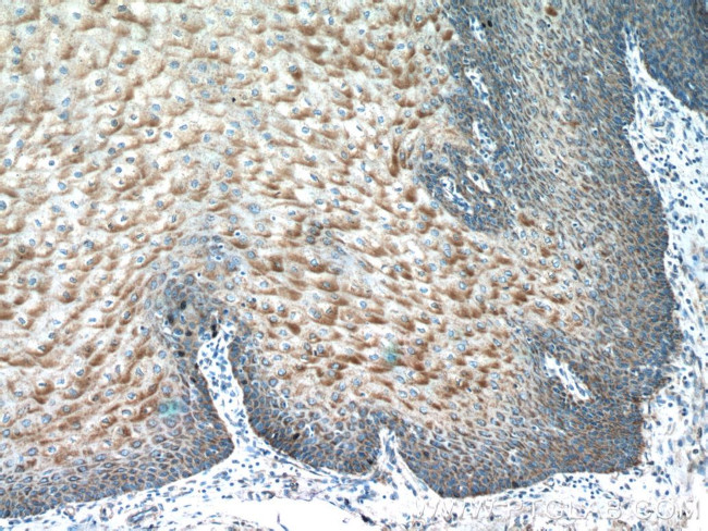 IL36 gamma Antibody in Immunohistochemistry (Paraffin) (IHC (P))