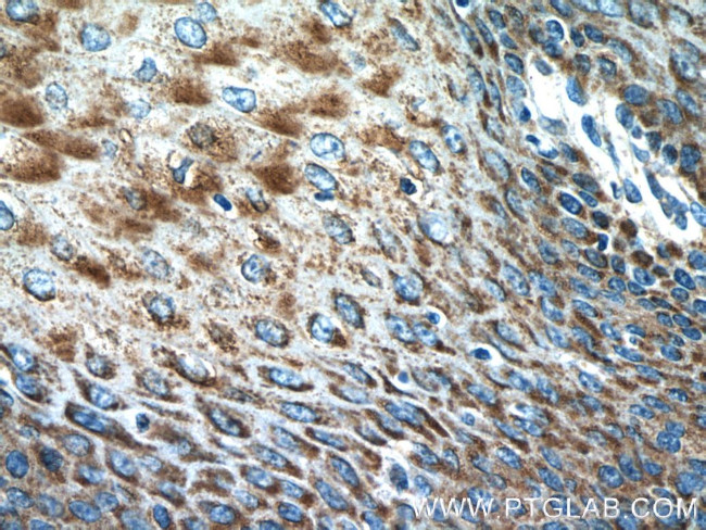 IL36 gamma Antibody in Immunohistochemistry (Paraffin) (IHC (P))