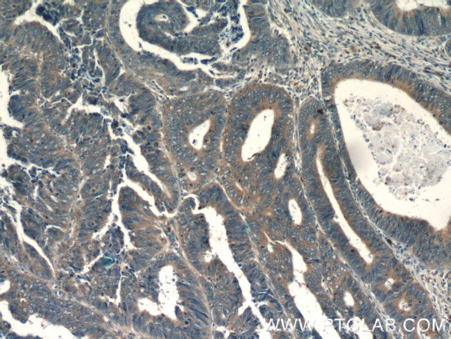 IL36 gamma Antibody in Immunohistochemistry (Paraffin) (IHC (P))