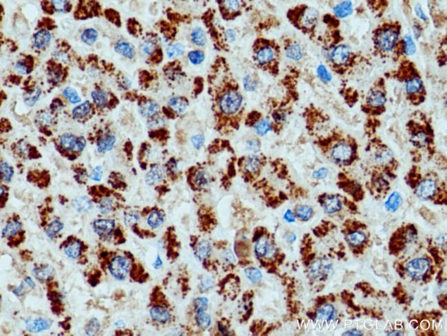 Catalase Antibody in Immunohistochemistry (Paraffin) (IHC (P))