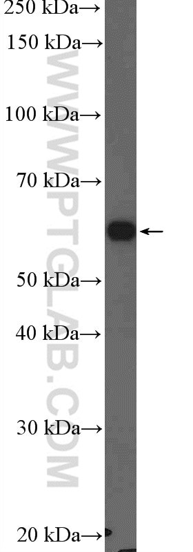 Catalase Antibody in Western Blot (WB)