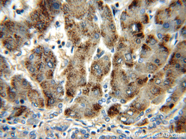 Catalase Antibody in Immunohistochemistry (Paraffin) (IHC (P))