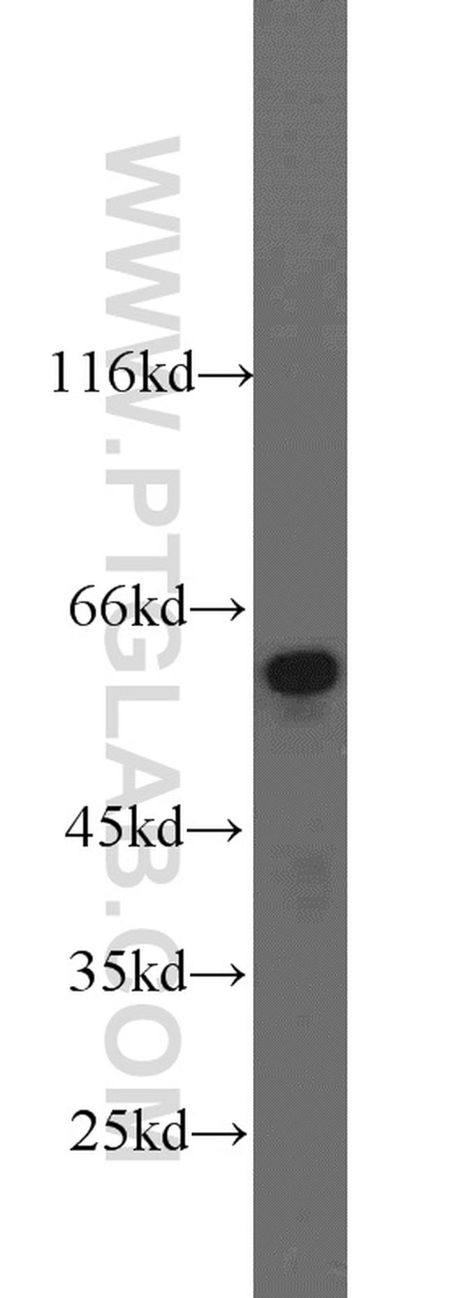 Catalase Antibody in Western Blot (WB)