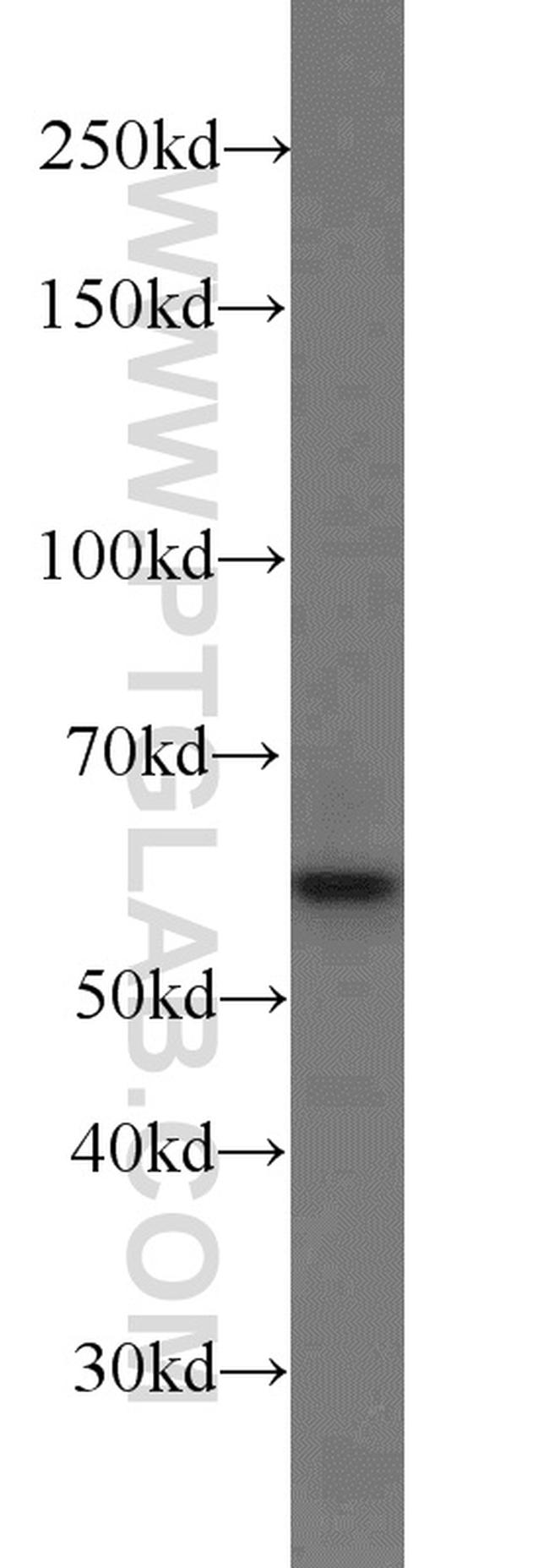 Catalase Antibody in Western Blot (WB)