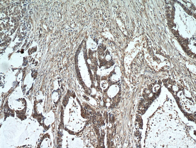 CTR9 Antibody in Immunohistochemistry (Paraffin) (IHC (P))