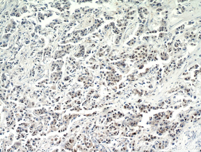 CTR9 Antibody in Immunohistochemistry (Paraffin) (IHC (P))