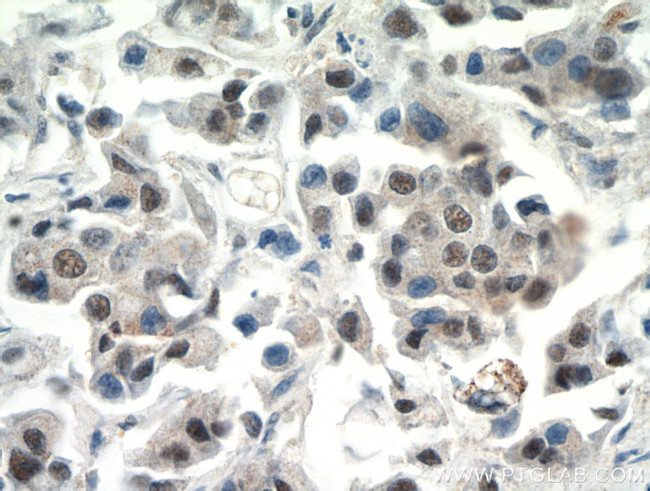 CTR9 Antibody in Immunohistochemistry (Paraffin) (IHC (P))
