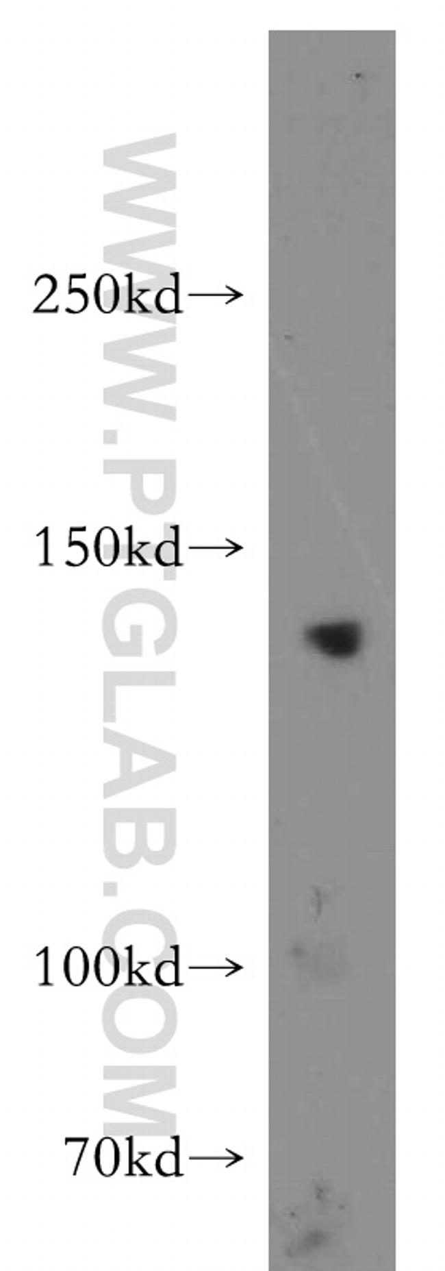 CTR9 Antibody in Western Blot (WB)