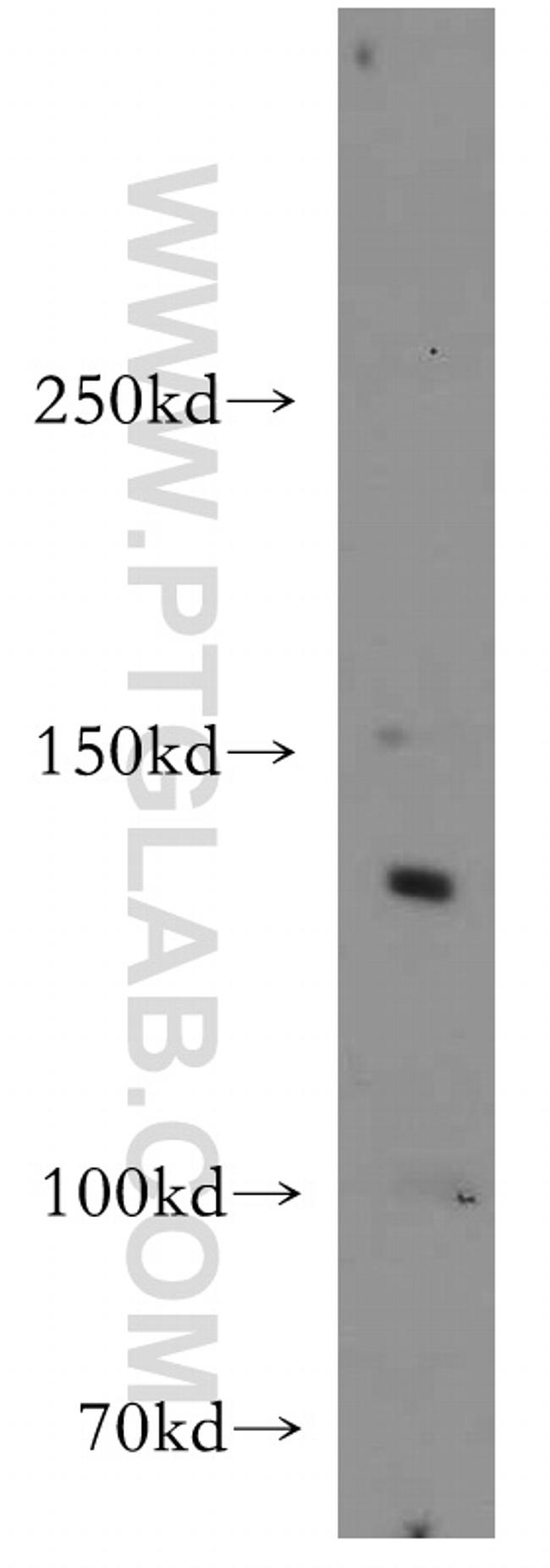 CTR9 Antibody in Western Blot (WB)