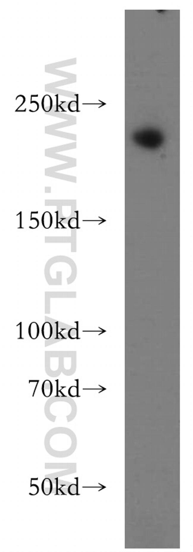 RB1CC1 Antibody in Western Blot (WB)