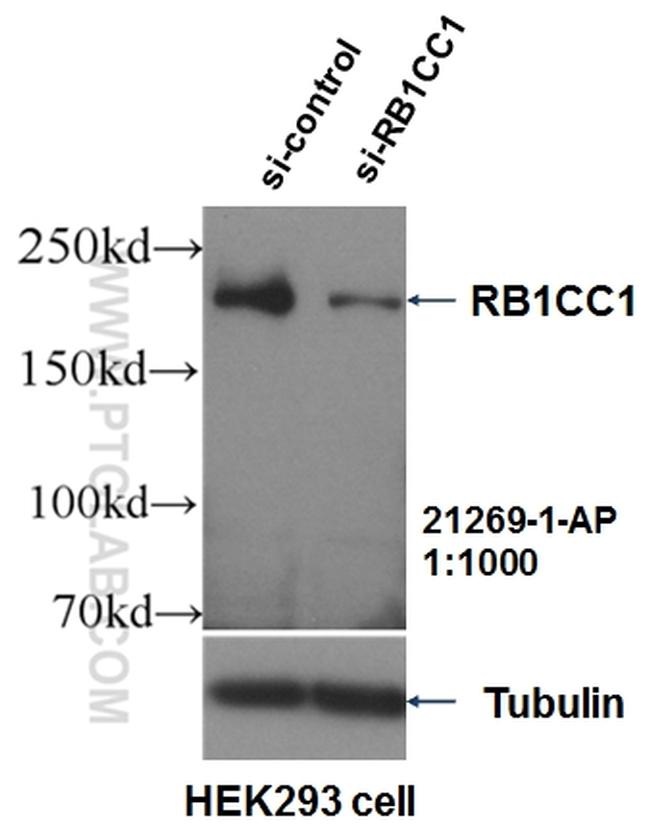 RB1CC1 Antibody in Western Blot (WB)