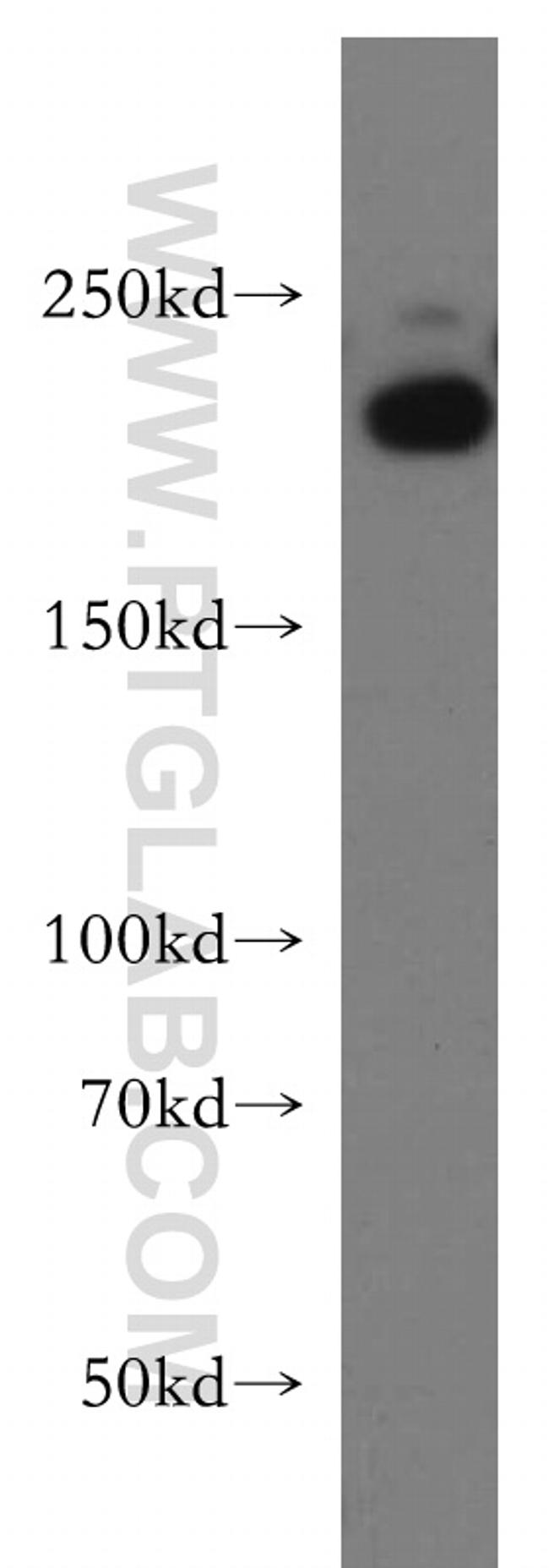 RB1CC1 Antibody in Western Blot (WB)