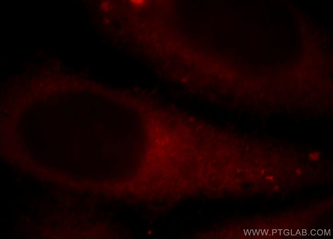 SR-BI Antibody in Immunocytochemistry (ICC/IF)