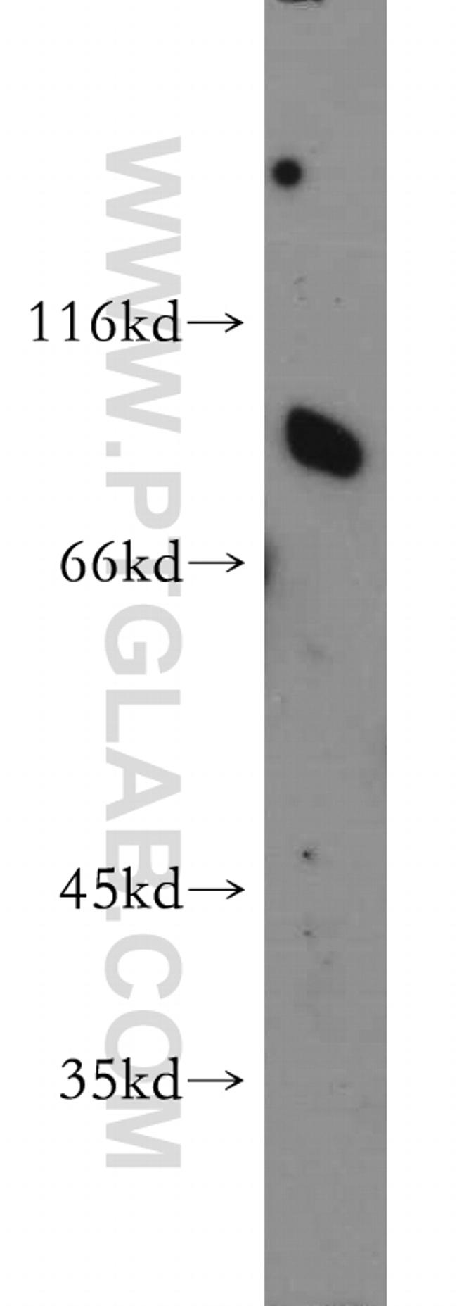 SR-BI Antibody in Western Blot (WB)