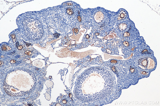 ZP3 Antibody in Immunohistochemistry (Paraffin) (IHC (P))