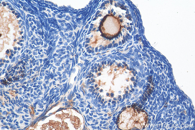 ZP3 Antibody in Immunohistochemistry (Paraffin) (IHC (P))