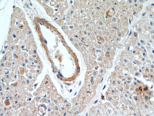 WBSCR17 Antibody in Immunohistochemistry (Paraffin) (IHC (P))