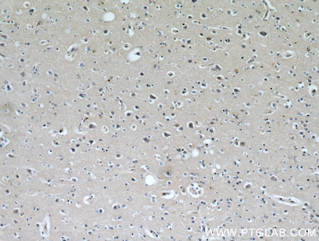 WBSCR17 Antibody in Immunohistochemistry (Paraffin) (IHC (P))