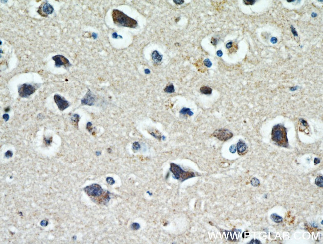 WBSCR17 Antibody in Immunohistochemistry (Paraffin) (IHC (P))