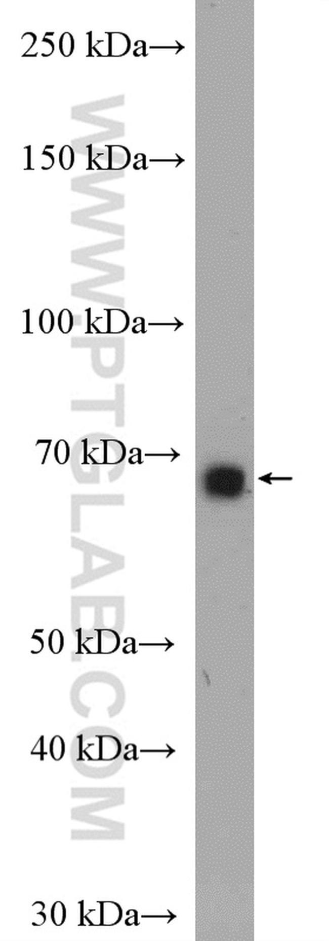 WBSCR17 Antibody in Western Blot (WB)