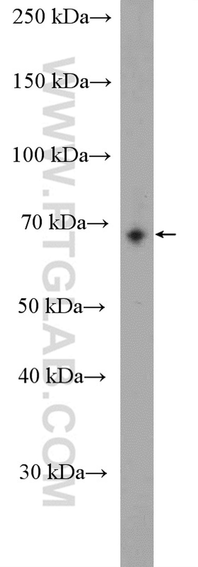 WBSCR17 Antibody in Western Blot (WB)