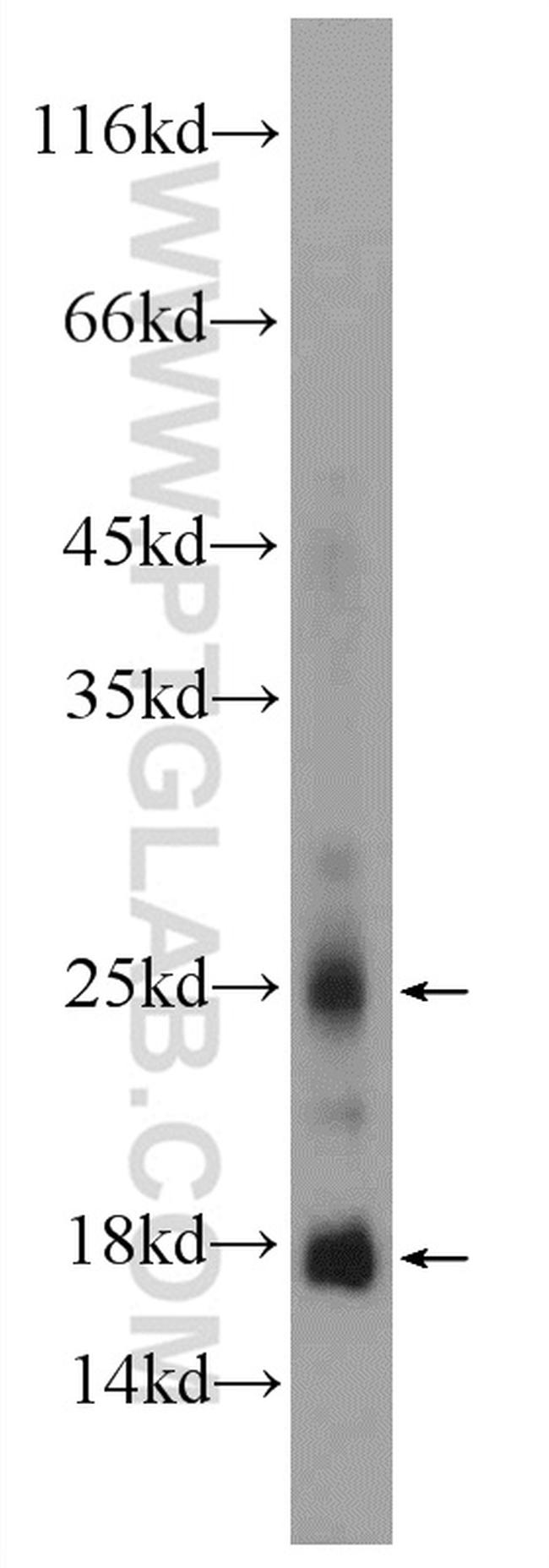 CRYGN Antibody in Western Blot (WB)