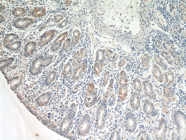 MOGAT2 Antibody in Immunohistochemistry (Paraffin) (IHC (P))