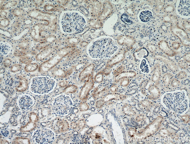 MOGAT2 Antibody in Immunohistochemistry (Paraffin) (IHC (P))