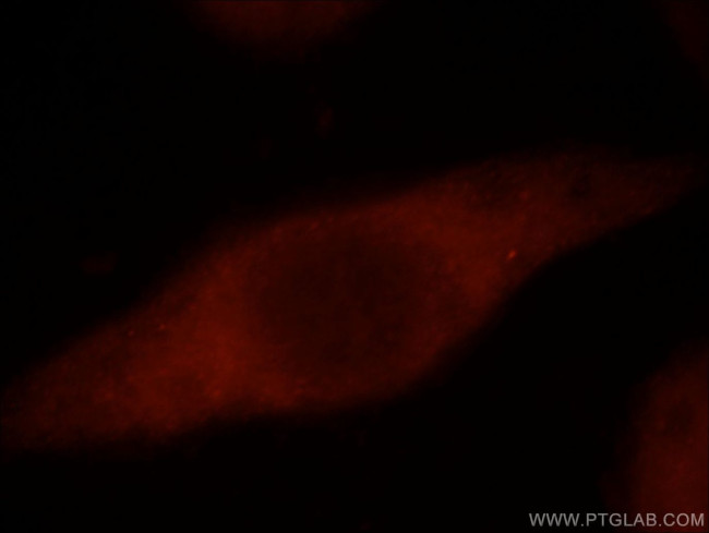 SMYD2 Antibody in Immunocytochemistry (ICC/IF)