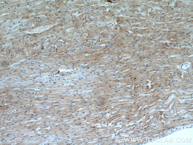 SMYD2 Antibody in Immunohistochemistry (Paraffin) (IHC (P))