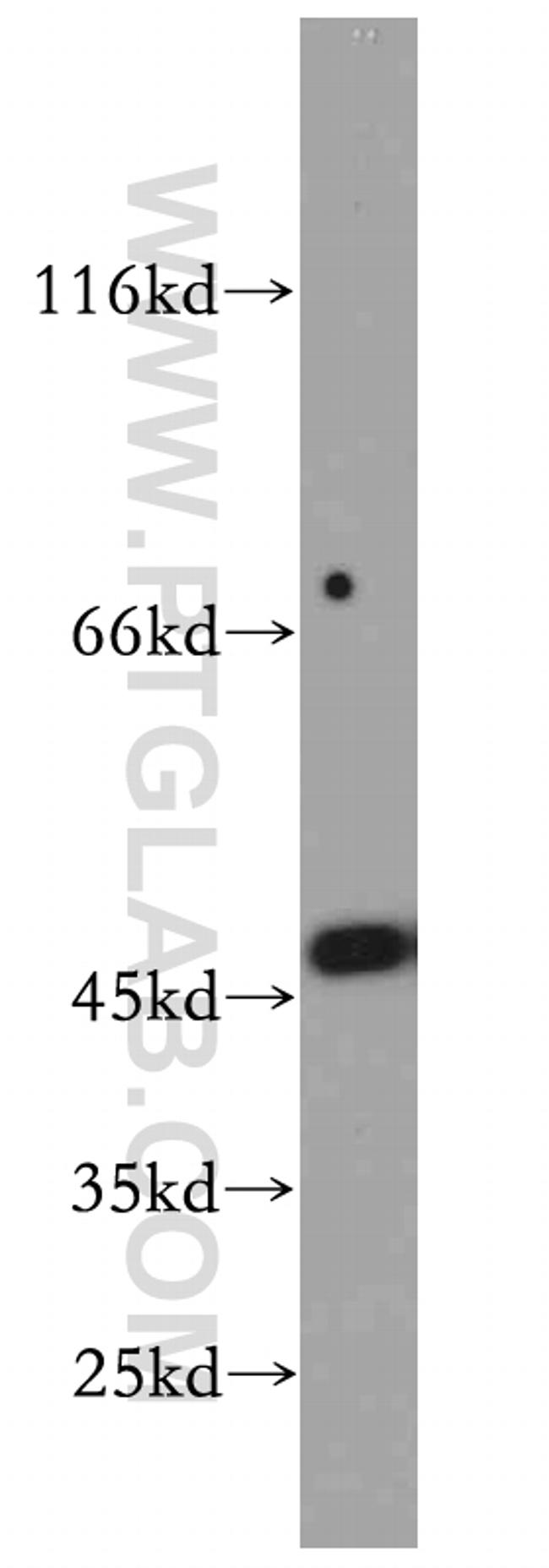 SMYD2 Antibody in Western Blot (WB)