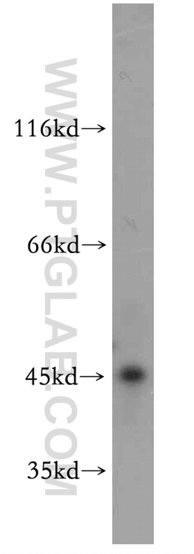 SMYD2 Antibody in Western Blot (WB)