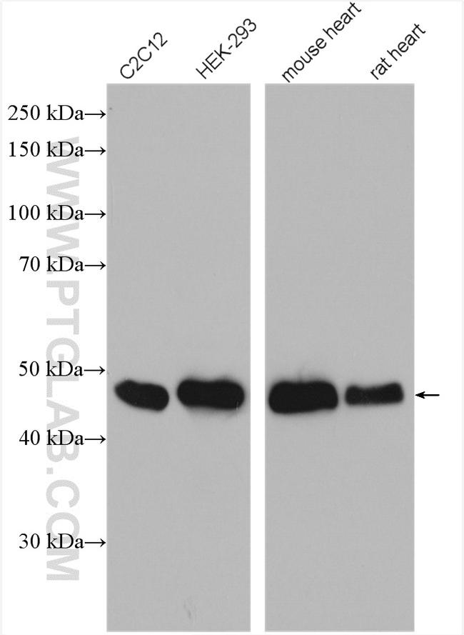 SMYD2 Antibody in Western Blot (WB)