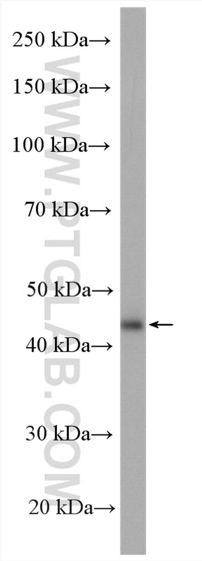 B3GNT6 Antibody in Western Blot (WB)