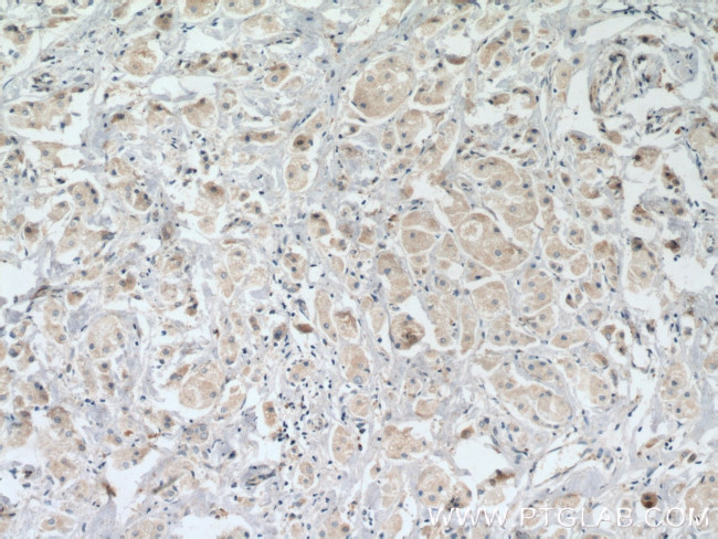 MANEA Antibody in Immunohistochemistry (Paraffin) (IHC (P))