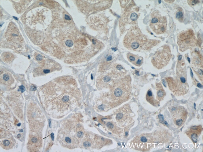 MANEA Antibody in Immunohistochemistry (Paraffin) (IHC (P))