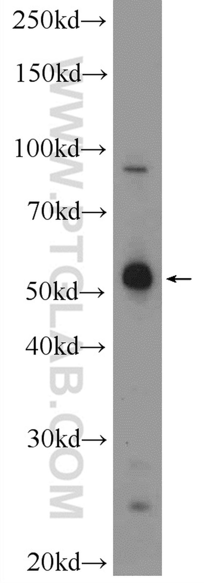 MANEA Antibody in Western Blot (WB)