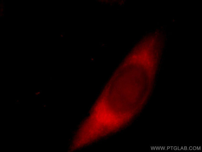 JAML Antibody in Immunocytochemistry (ICC/IF)