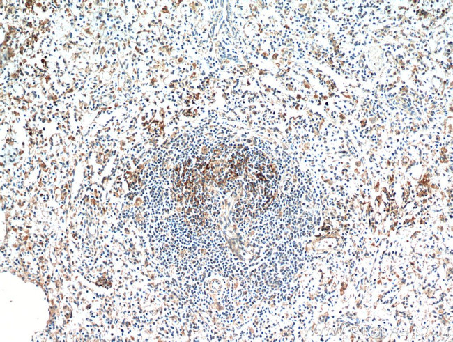 JAML Antibody in Immunohistochemistry (Paraffin) (IHC (P))