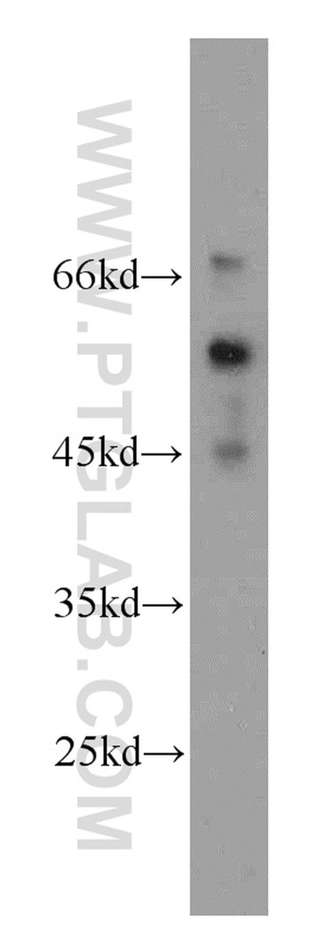 JAML Antibody in Western Blot (WB)