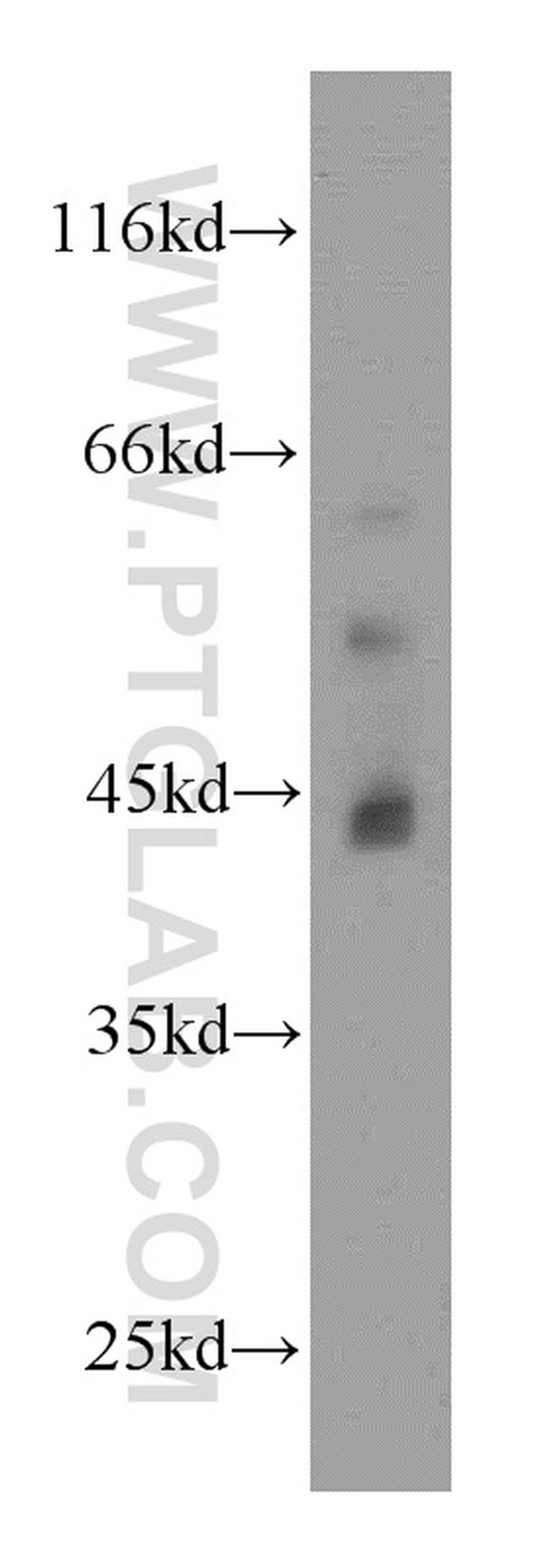 JAML Antibody in Western Blot (WB)