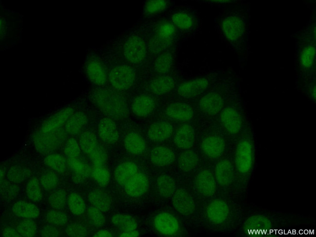 SIX4 Antibody in Immunocytochemistry (ICC/IF)