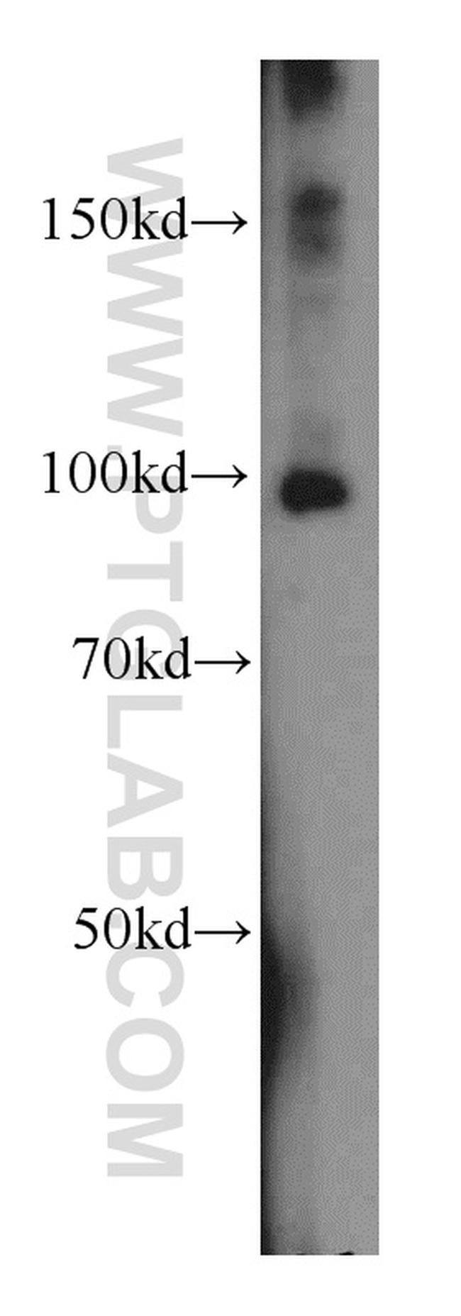 SIX4 Antibody in Western Blot (WB)