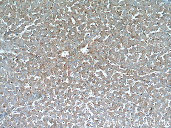 C5aR Antibody in Immunohistochemistry (Paraffin) (IHC (P))