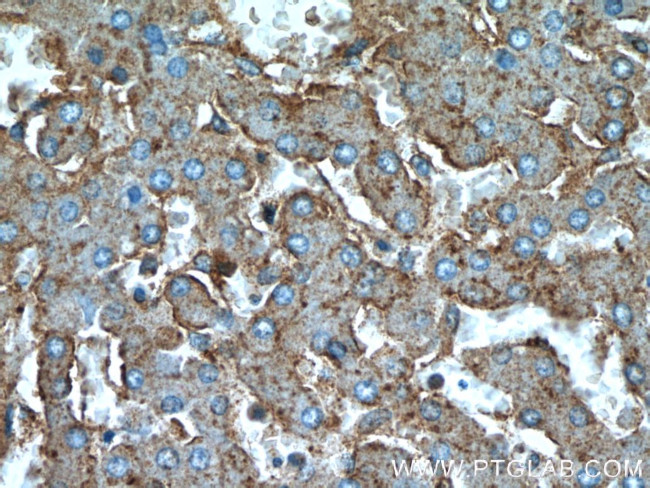 C5aR Antibody in Immunohistochemistry (Paraffin) (IHC (P))