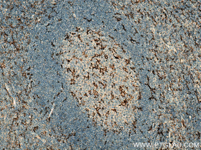 C5aR Antibody in Immunohistochemistry (Paraffin) (IHC (P))