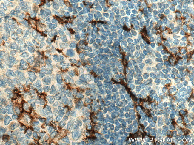 C5aR Antibody in Immunohistochemistry (Paraffin) (IHC (P))